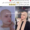 شقيقه محاربة السرطان بالإسماعيلية 