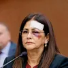 سيدة فنزويلا الأولى وعلى وجهها آثار العنف