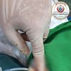 العملية 