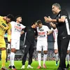 تحديات الزمالك أمام الجيش الرواندي 