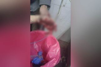 إصابة طفل صغير بصاروخ في يده ببني سويف 