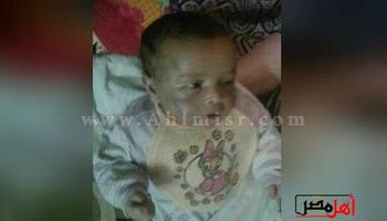 صور الرضيع الذى تعرض للتعذيب على يد والده 