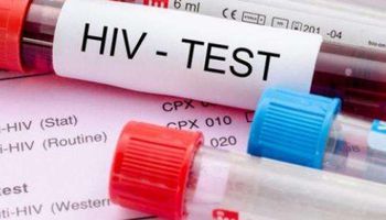  تحليل HIV 