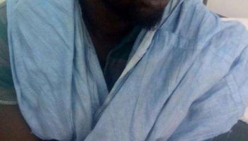 صور آثار تعذيب مدون معارض في موريتانيا