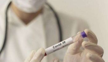 فيروس كورونا في مختبر