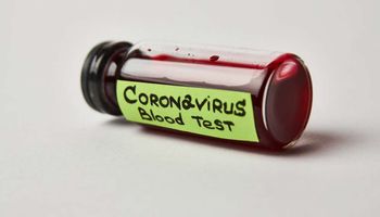 لقاح فيروس كورونا