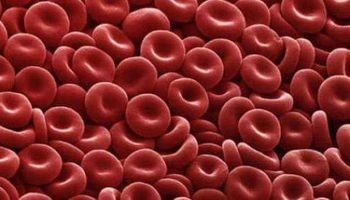 ما هو سرطان الدم؟