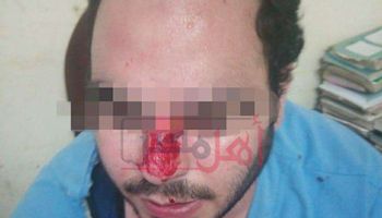 الطبيب المعندى عليه