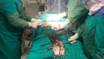 مستشفى الأقصر العام ينجح في إتمام عملية جراحيه لسيدة مصابة بكورونا 