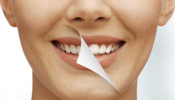 علاجات منزلية لتبيض الأسنان