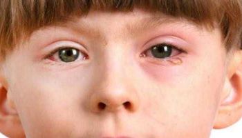أنواع وأعراض امراض شبكية العين