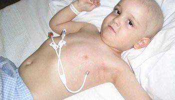 سرطان الدم عند الأطفال