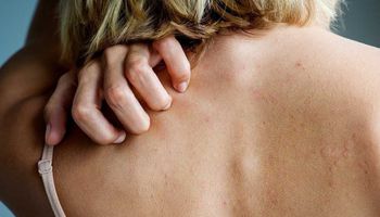 علاجات طبيعة لحساسية الجلد