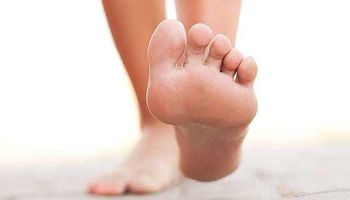 علاج فطريات أظافر القدم 