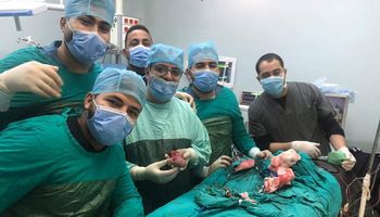 جراحة نادرة بمستشفيات جامعة المنيا لاستئصال توأم مسخي ملتصق لطفلة في أسبوعها الأول لأم مصابة بكرورنا