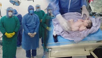 إجراء ولادة قيصرية لسيدة مصابة ب كورونا في قنا