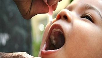 شلل الأطفال