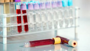 دراسة جديدة تكشف عدم وجود علاقة بين   فصيلة الدم وعدوى كورونا الشديدة