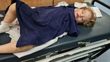 ارتفاع حصيلة ضحايا غزة إلى 181 شهيداً (صور)