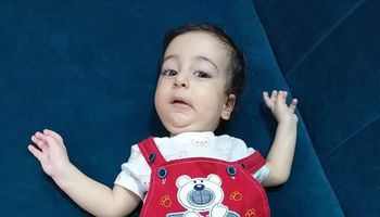 الطفل أحمد مريض ضمور العضلات الشوكية