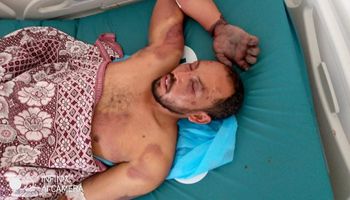 احمد حامد المصاب في ليبيا