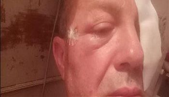 سائق قطار كفر الشيخ المصاب