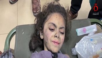 طفلة فلسطينية فقدت اسرتها