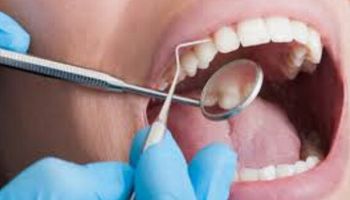 عامل نظافة تركي ينتحل صفة طبيب أسنان