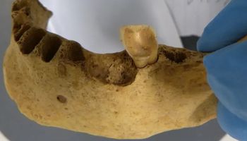 أسنان البشر القدماء 