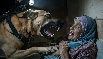 كلب إسرائيلي يهاجم فلسطينية 