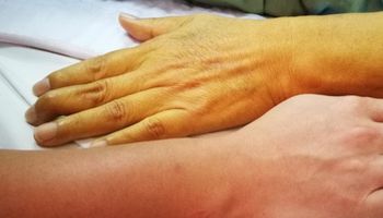 زراعة الجلد