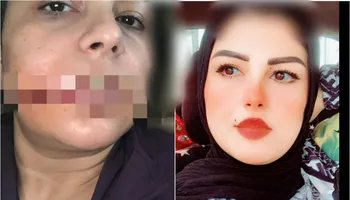 «مش هتكوني ليا ولا لغيري».. «منى» انتقم منها طليقها على طريقة «نيرة أشرف» ببورسعيد: دمر حياتي ولسه بيطاردني