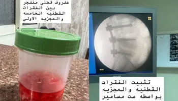 الإشاعة 