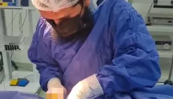 جانب من العملية
