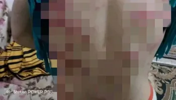 عروس بني سويف ضحية ضرب وتعذيب زوجها