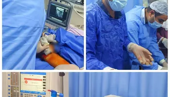 جانب من العملية الجراحية 