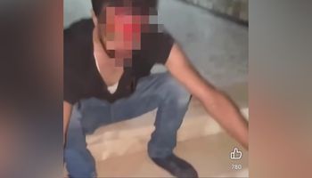 صغار يعتدون على شاب بالإسكندرية