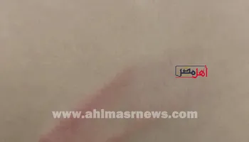 جانب من الاعتداء