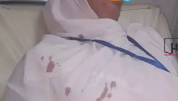 الممرضة