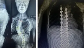 جانب من العملية الجراحية 