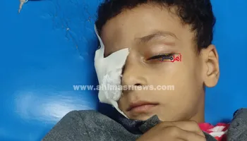 الطفل عمر ياسر 