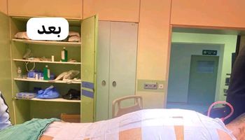 المريض بعد إجراء العملية 