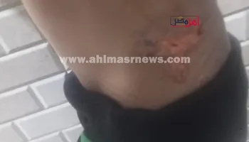 احد الابناء المعتدى عليهم 