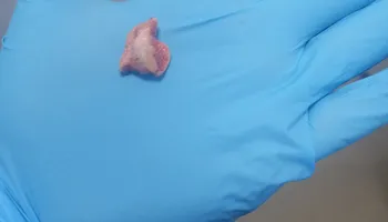 استخراج زلطة من المرئي لطفل 