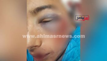 الطالب المعتدي عليه 