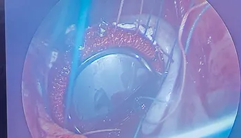 جانب من العملية الجراحية 