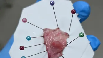 جانب من العملية الجراحية 