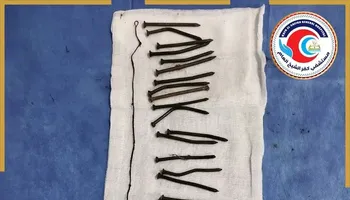 جانب من العملية الجراحية 