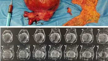 جانب من العملية الجراحية 