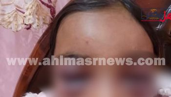 صور الطفلتين